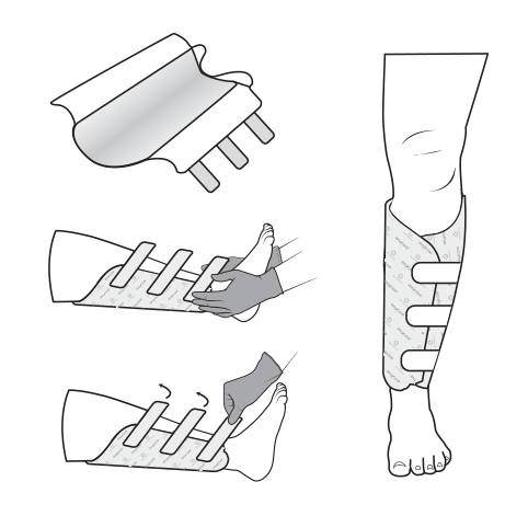 ExuCare® - 5 Pack